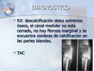 DIAGNOSTICO

   RX: descalcificación delos extremos
    óseos, el canal medular no esta
    cerrado, no hay fibrosis marginal y se
    encuentra sombras de calcificación en
    las partes blandas.

   TAC
 