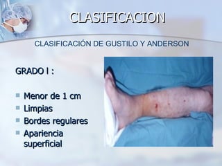 CLASIFICACION
      CLASIFICACIÓN DE GUSTILO Y ANDERSON


GRADO l :

   Menor de 1 cm
   Limpias
   Bordes regulares
   Apariencia
    superficial
 