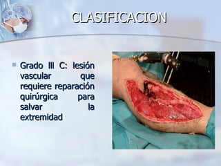 CLASIFICACION


   Grado lll C: lesión
    vascular        que
    requiere reparación
    quirúrgica     para
    salvar            la
    extremidad
 