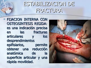ESTABILIZACION DE
                  FRACTURA
   FIJACION INTERNA CON
    OSTEOSINTESIS RIGIDA:
    es una indicación precisa
    en        las     fracturas
    articulares      y      los
    desprendimientos
    epifisiarios,       permite
    obtener una reducción
    anatómica        de      la
    superficie articular y una
    rápida movilidad.
 