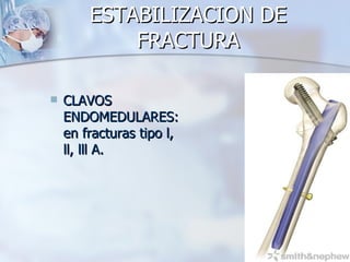ESTABILIZACION DE
            FRACTURA

   CLAVOS
    ENDOMEDULARES:
    en fracturas tipo l,
    ll, lll A.
 