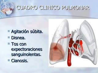 CUADRO CLINICO PULMONAR



 Agitación súbita.
 Disnea.
 Tos con
  expectoraciones
  sanguinolentas.
 Cianosis.
 