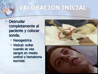   Desnudar
    completamente al
    paciente y colocar
    sonda.
       Nasogastrica
       Vesical: evitar
        cuando se vea
        sangre en meato
        uretral o hematoma
        escrotal.
 