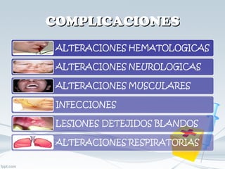 COMPLICACIONES 