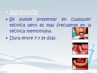 EQUIMOSIS: Se puede presentar en cualquier técnica pero es mas frecuente en la técnica mentoniana. Dura entre 7 y 14 días. 