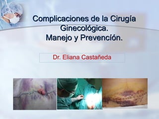 Complicaciones de la Cirugía
Ginecológica.
Manejo y Prevencíón.
Dr. Eliana Castañeda
 