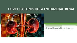 COMPLICACIONES DE LA ENFERMEDAD RENAL
Cristian Alejandro Rivera Cervantes
 