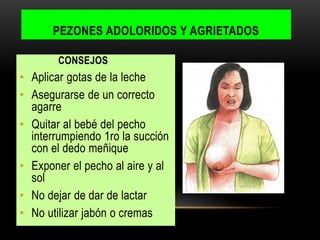 CONSEJOS
• Aplicar gotas de la leche
• Asegurarse de un correcto
agarre
• Quitar al bebé del pecho
interrumpiendo 1ro la succión
con el dedo meñique
• Exponer el pecho al aire y al
sol
• No dejar de dar de lactar
• No utilizar jabón o cremas
PEZONES ADOLORIDOS Y AGRIETADOS
 