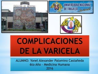COMPLICACIONES
DE LA VARICELA
ALUMNO: Yonel Alexander Palomino Castañeda
6to Año – Medicina Humana
2016
 
