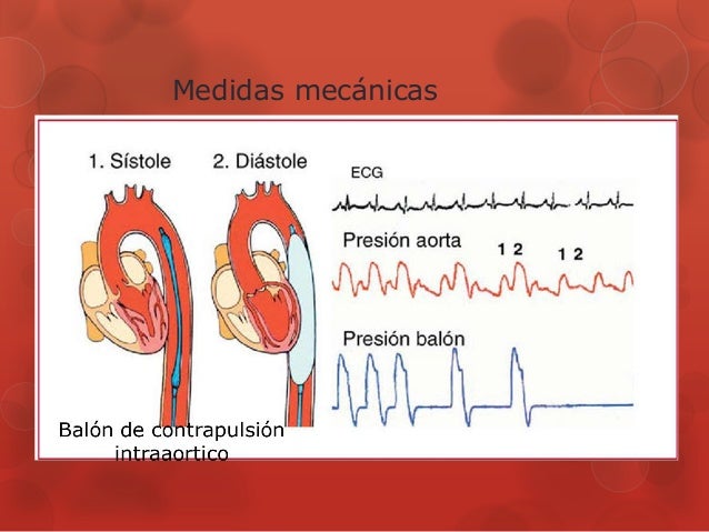 Aquí es whay usted debe hacer sobre definicion hipertensión