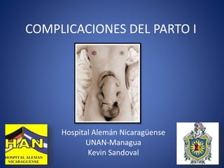COMPLICACIONES DEL PARTO I
Hospital Alemán Nicaragüense
UNAN-Managua
Kevin Sandoval
 