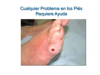 Cualquier Problema en los Piés Requiere Ayuda  