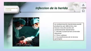 Complicaciones en el post operatorio exp.pptx