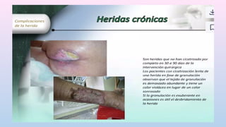 Complicaciones en el post operatorio exp.pptx