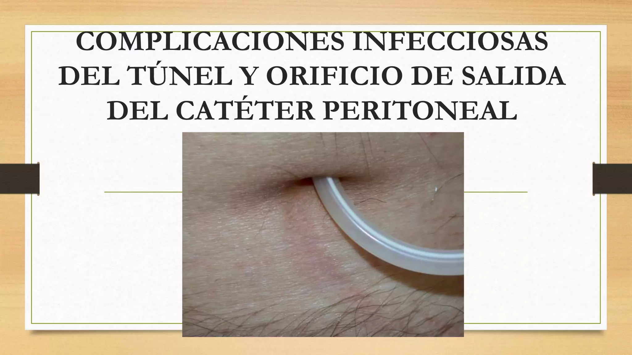 COMPLICACIONES INFECCIOSAS (1).pptx