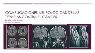 COMPLICACIONES NEUROLÓGICAS DE LAS 
TERAPIAS CONTRA EL CÁNCER 
DR. JOSÉ PINTO LLERENA 
MR3MI-CHMDRAAM 
 