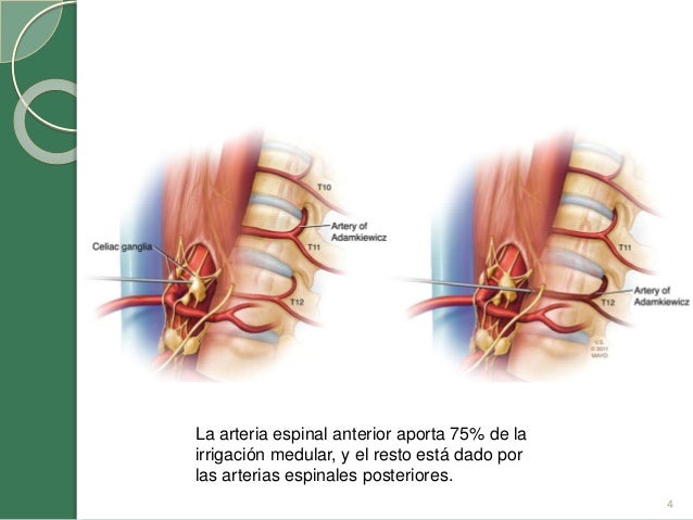 Complicaciones neurologicas por anestesia neuroaxial
