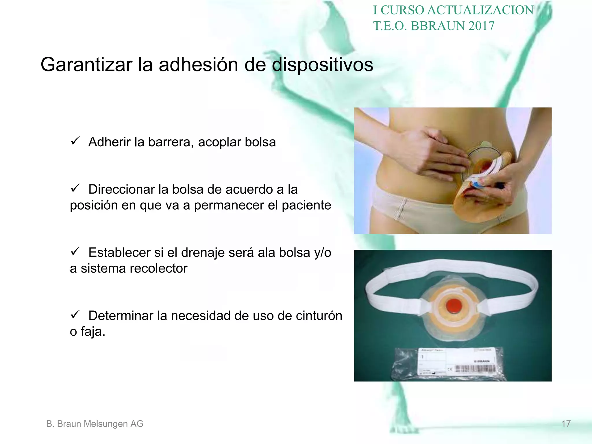 COMPLICACIONES OSTOMIAS Curso I Actualizacion Terapia_ Enterostomal ...
