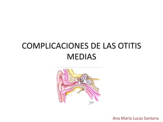COMPLICACIONES DE LAS OTITIS 
MEDIAS 
Ana María Lucas Santana 
 