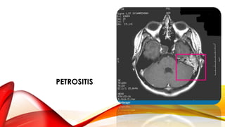 PETROSITIS
 