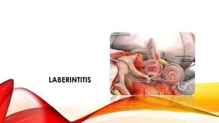 LABERINTITIS
 