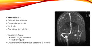 • Asociado a :
• Fiebre intermitente
• Datos de toxemia
• Torticolis
• Embolizacion séptica
• Trombosis (raro)
• Vena Yugular Interna
• Bulbo Yugular
• Ocasionando Trombosis cerebral o Infarto
 
