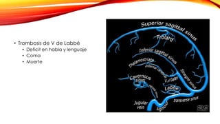• Trombosis de V de Labbé
• Deficit en habla y lenguaje
• Coma
• Muerte
 