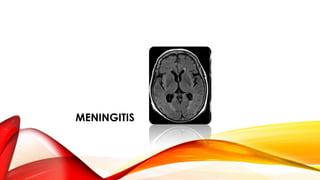 MENINGITIS
 