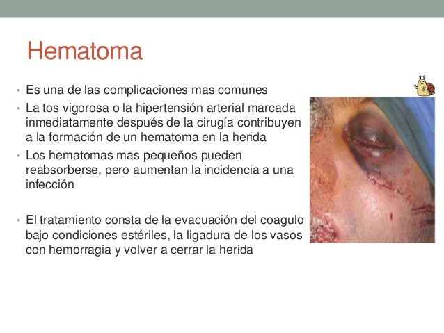 Como deja ir tabeks en la farmacia