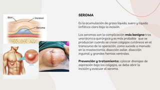 Complicaciones Quir rgicas M s Frecuentes PDF complicaciones-quir-rgicas-m-s-frecuentes-pdf