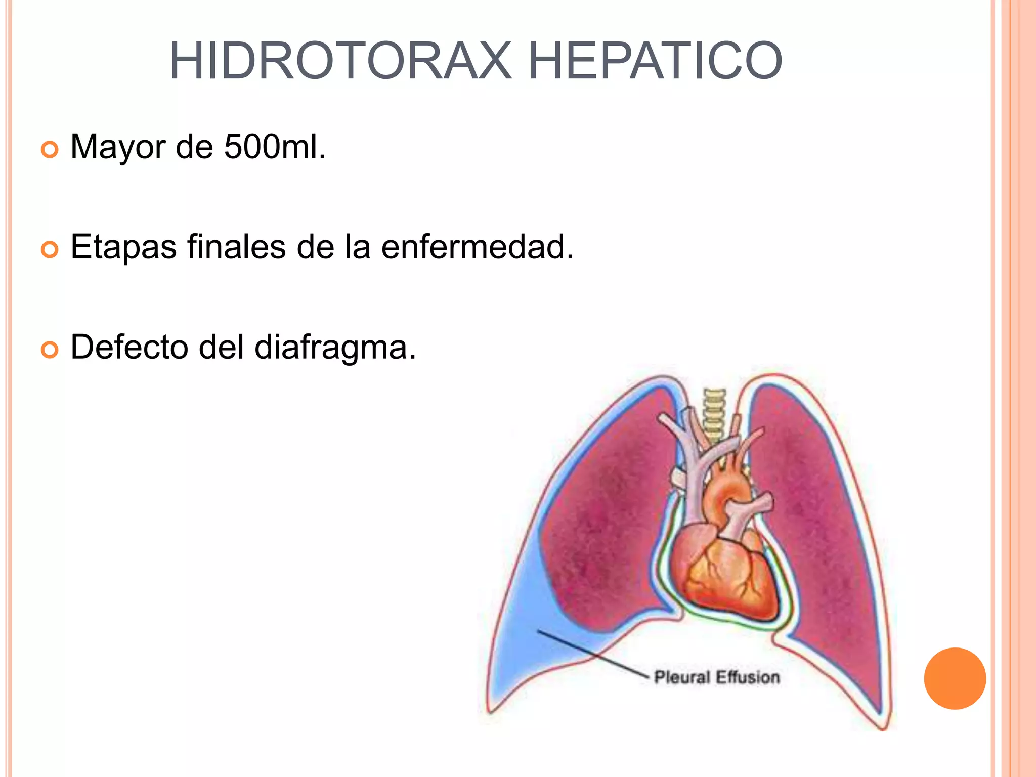 HIDROTORAX HEPATICO
Mayor de 500ml.
Etapas finales de la enfermedad.
Defecto del diafragma.