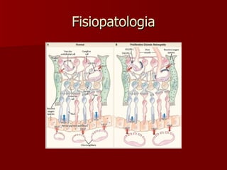 Fisiopatologia 