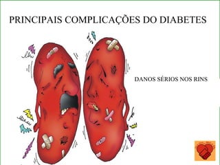 Copyright © RHVIDA S/C Ltda. www.rhvida.com.br
C O N S E Q U Ê N C IA D A P R E S S Ã O A LTA
“ D a n o s é r io n o s r in s .“
DANOS SÉRIOS NOS RINS
PRINCIPAIS COMPLICAÇÕES DO DIABETES
 