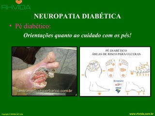 Copyright © RHVIDA S/C Ltda. www.rhvida.com.br
NEUROPATIA DIABÉTICA
• Pé diabético:
Orientações quanto ao cuidado com os pés!
 