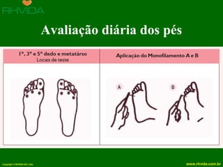Copyright © RHVIDA S/C Ltda. www.rhvida.com.br
Avaliação diária dos pés
 