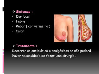  Sintomas :
• Dor local
• Febre
• Rubor ( cor vermelha )
• Calor



 Tratamento :
Recorrer ao antibiótico e analgésicos se não poderá
haver necessidade de fazer uma cirurgia .
 