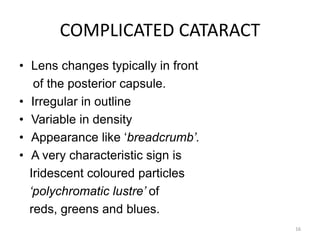 COMPLICATED CATARACT
• Lens changes typically in front
of the posterior capsule.
• Irregular in outline
• Variable in density
• Appearance like ‘breadcrumb’.
• A very characteristic sign is
Iridescent coloured particles
‘polychromatic lustre’ of
reds, greens and blues.
16
 