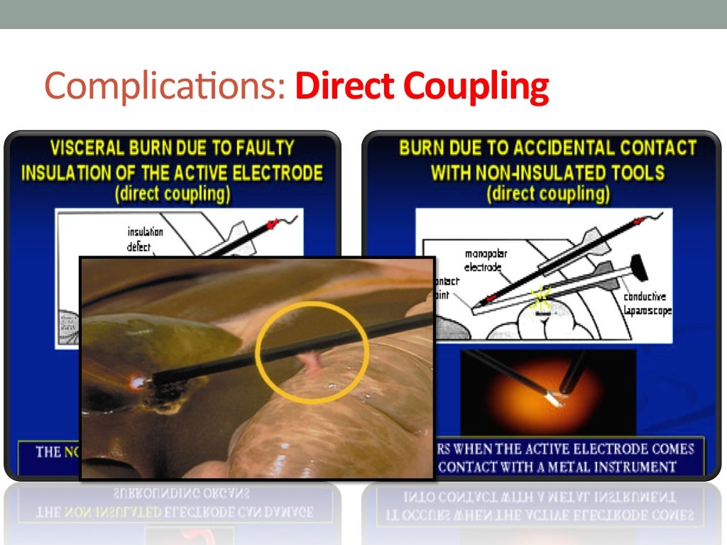 Complication of laparoscopy