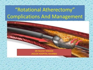 “Rotational Atherectomy”
Complications And Management
DR NILESH TAWADE
JASLOK HOSPITAL MUMBAI
 