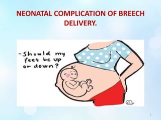 NEONATAL COMPLICATION OF BREECH
DELIVERY.
1
 