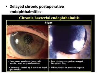 • Delayed chronic postoperative
endophthalmities-
 