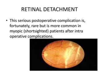 RETINAL DETACHMENT
• This serious postoperative complication is,
fortunately, rare but is more common in
myopic (shortsighted) patients after intra
operative complications.
 