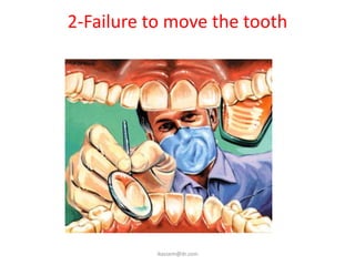2-Failure to move the tooth
ikassem@dr.com
 