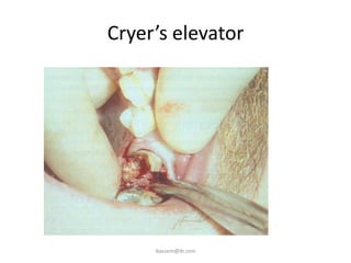 Cryer’s elevator
ikassem@dr.com
 