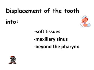 Displacement of the tooth
into:
-soft tissues
-maxillary sinus
-beyond the pharynx
 