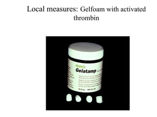 Local measures: Gelfoam with activated
thrombin
 