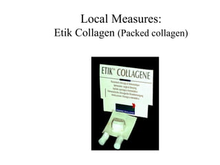 Local Measures:
Etik Collagen (Packed collagen)
 