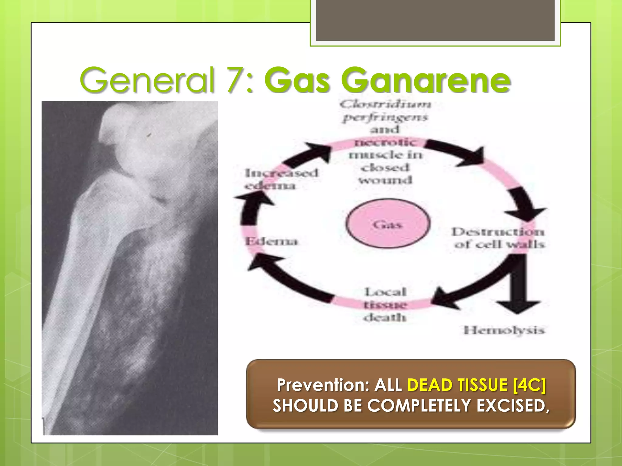 General 6: Fat EmbolismFat globules from marrow pushed into circulation by the force of trauma that causing embolic phenomena