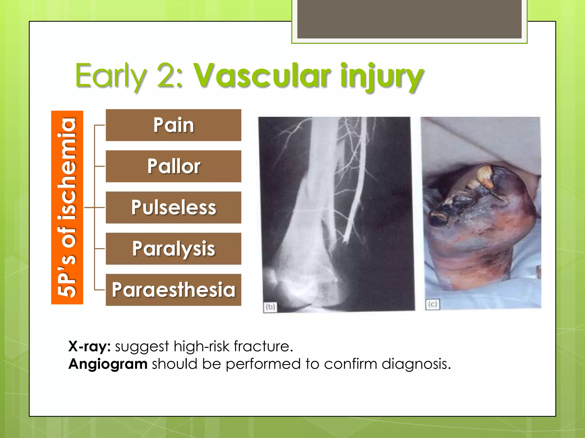 General 8: TetanusA condition after clostridium tetani infection that passes to anterior horn cells where it fixed and cant be neutralized later produces hyper-excitability and reflex muscle spasm 