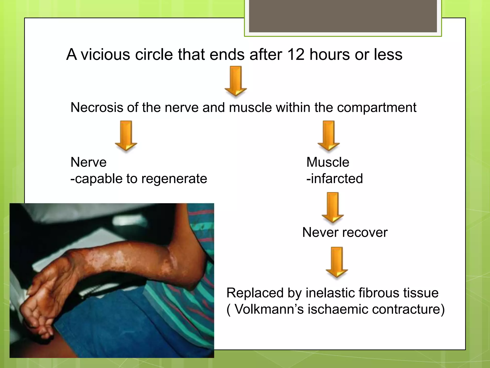 Early 3: Compartment SyndromeMost common sites (in ↓ freq): leg (after tibial fracture) -> forearm ->  thigh -> upper arm.  Other sites: hand, foot, abdomen, gluteal and cervical regions.High risk injuries:# of elbow, forearm bones, and proximal 3rd of tibia (30-70% after tibial #)multiple fracture of the foot or handcrush injuriescircumferential burns